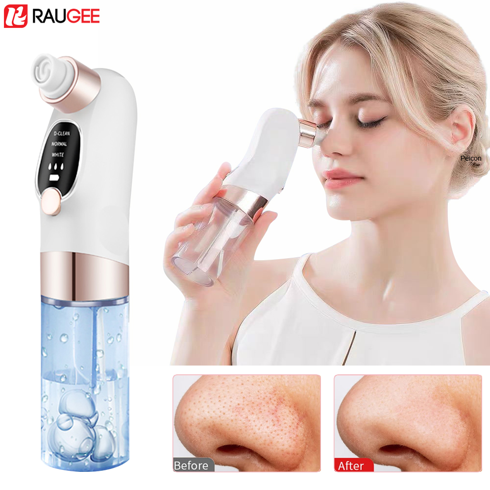 Blackhead Remover Electric Bla – обзор и цена Air Bubble Remover